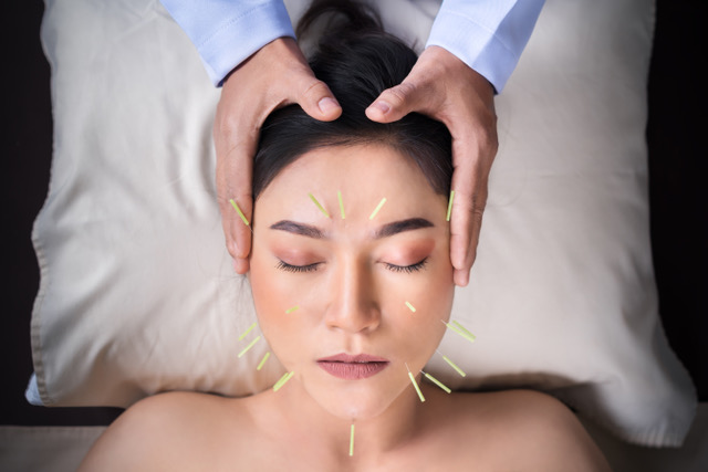 Cosmetic Acupuncture
